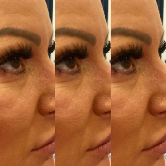 Estetic star by Maya #beograd