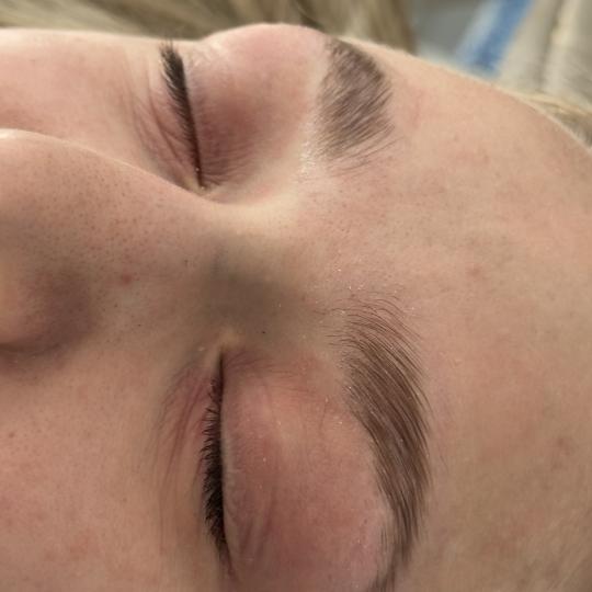 Lola esthetic center #beograd Obrve Brow lift Lice