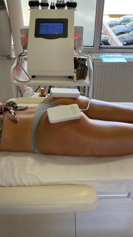 Lipolaser Centar - Matrix021 #novisad Tretmani tela