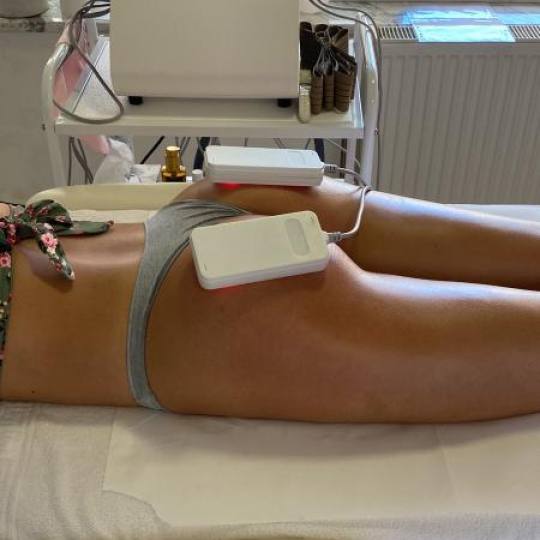 Lipolaser Centar - Matrix021 #novisad Tretmani tela 👉Neinvazivna liposukcija Diodnim laserom, zat