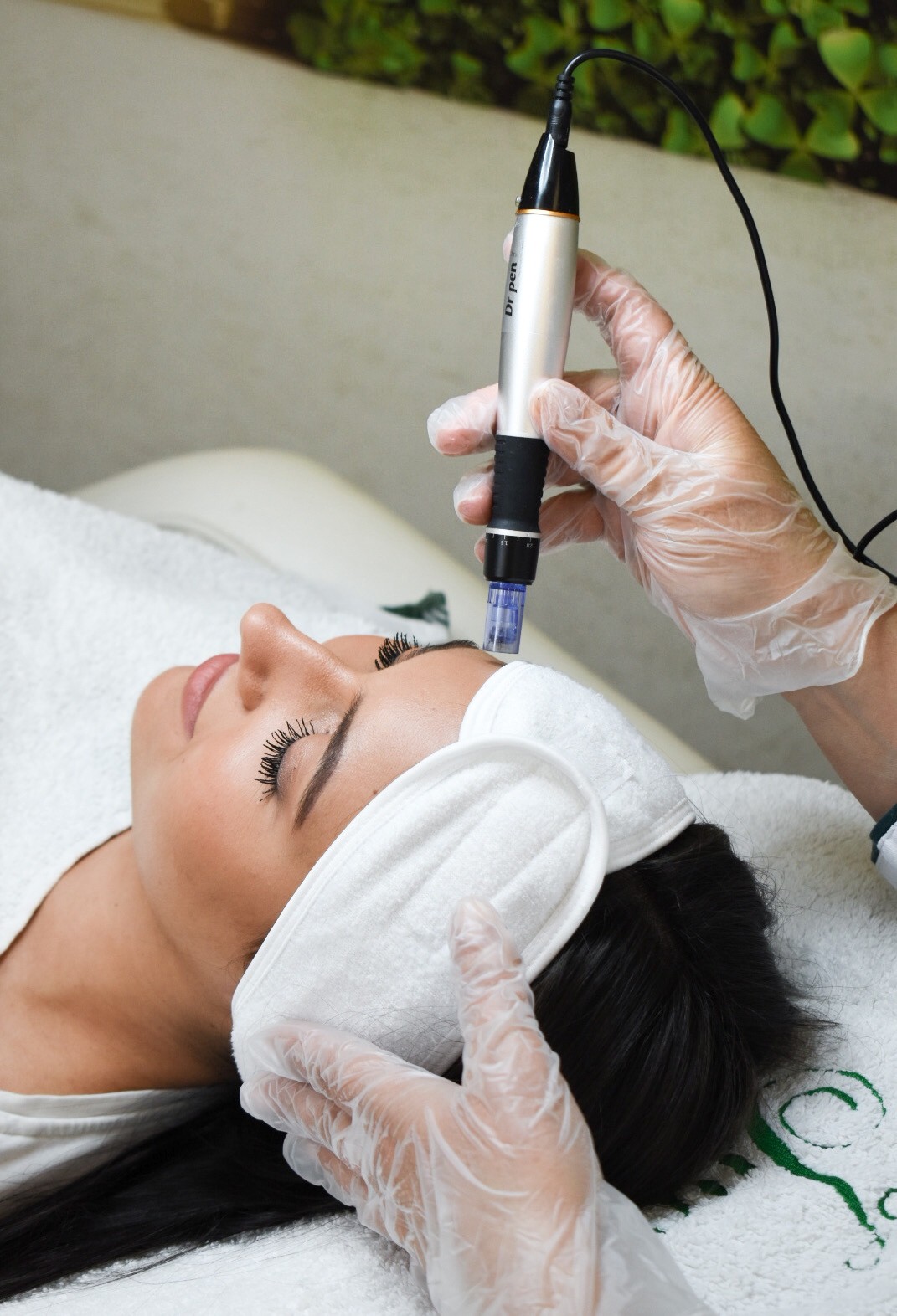 Dermapen sa hemijskim pilingom - Iva Beauty Lab, Beograd Tretman lica Lice Tretman lica, Beograd, Dušanovac, Šumice