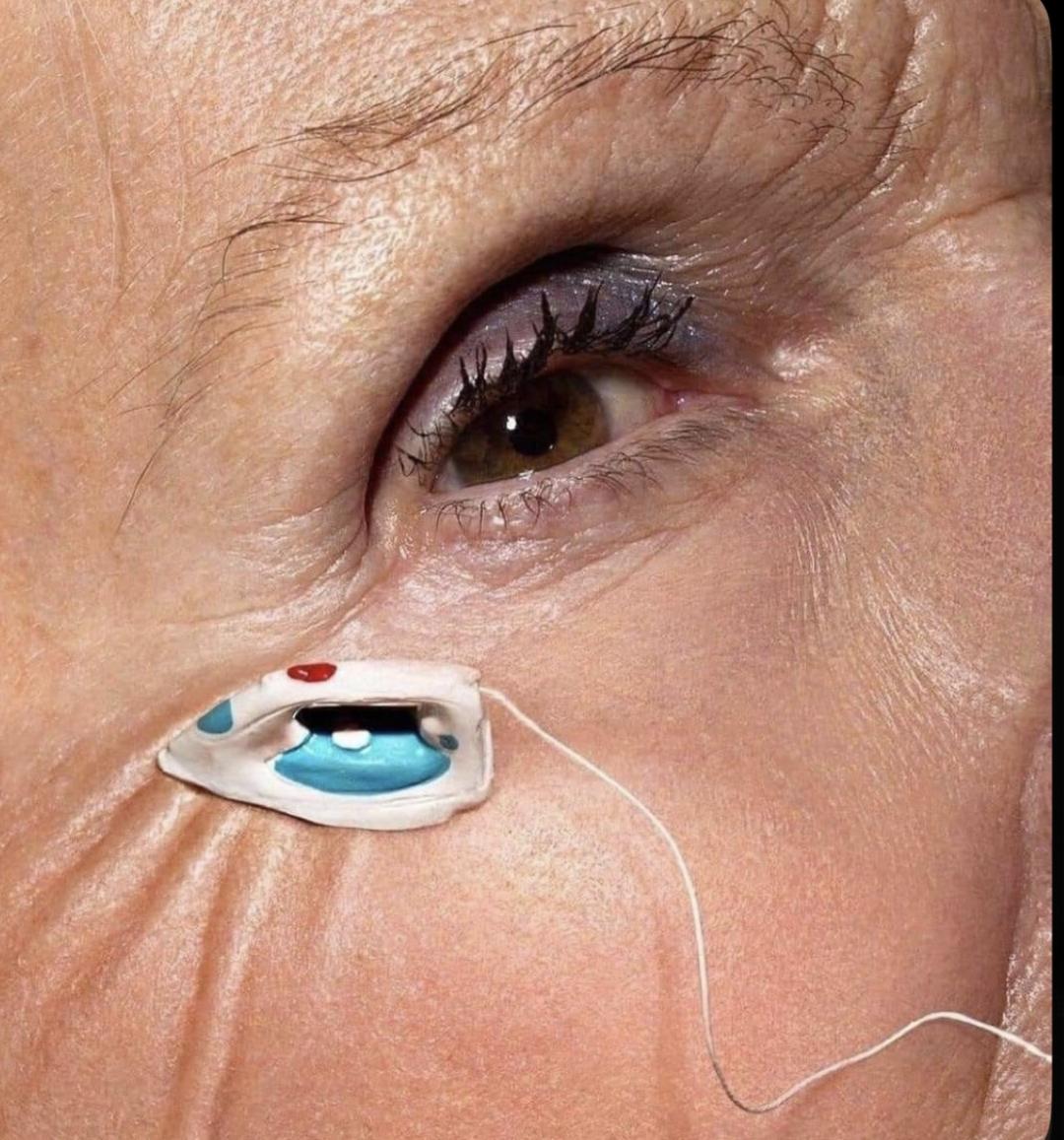 Radiotalasni lifting lica - Amelini beauty concept, Beograd Tretman lica Lice Tretman lica, Beograd, Zemun Centar