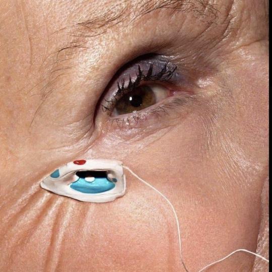 Amelini beauty concept #beograd Tretman lica Radiotalasni lifting lica