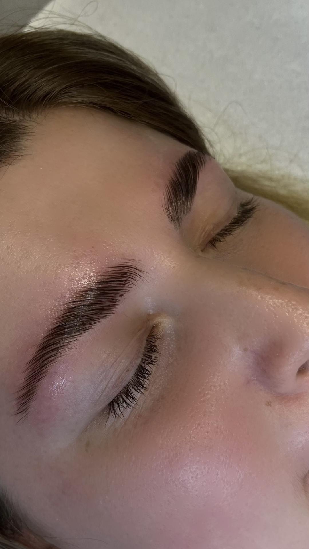 Brow lift - Artist Alex Studio, Niš Obrve Lice Obrve, Niš, Medijana