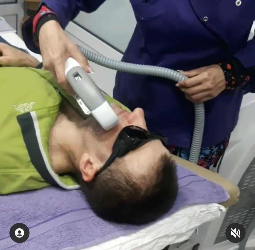 AltaBella Batajnica #beograd Laserski tretmani lica Lasersko uklanjanje akni i ožiljaka