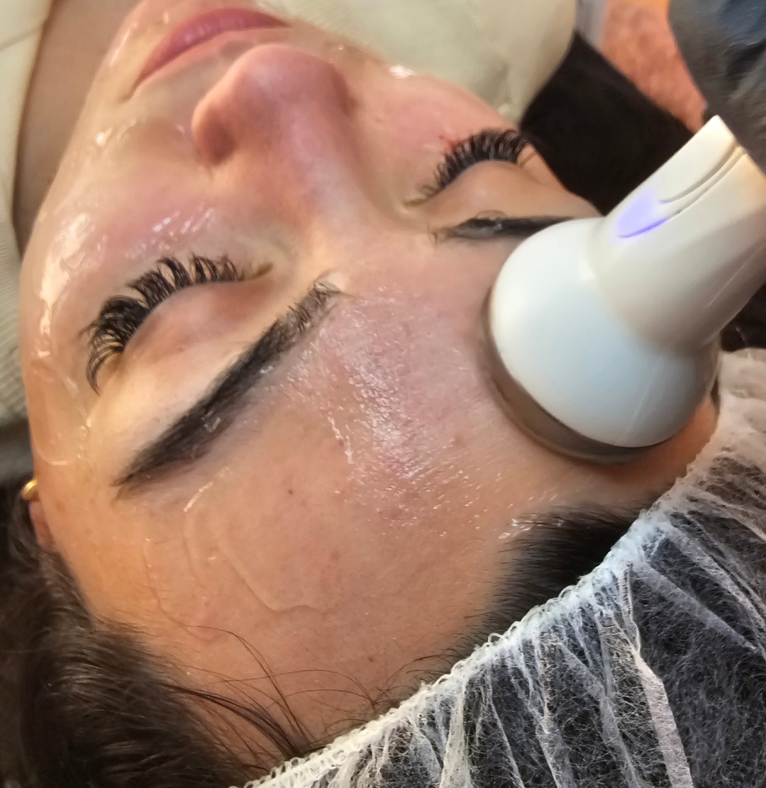 Esthetique Privé #beograd Tretman lica Klasican tretman lica + radiotalasni lifting