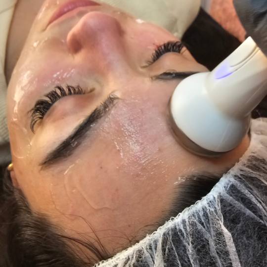 Esthetique Privé #beograd Tretman lica Klasican tretman lica + radiotalasni lifting