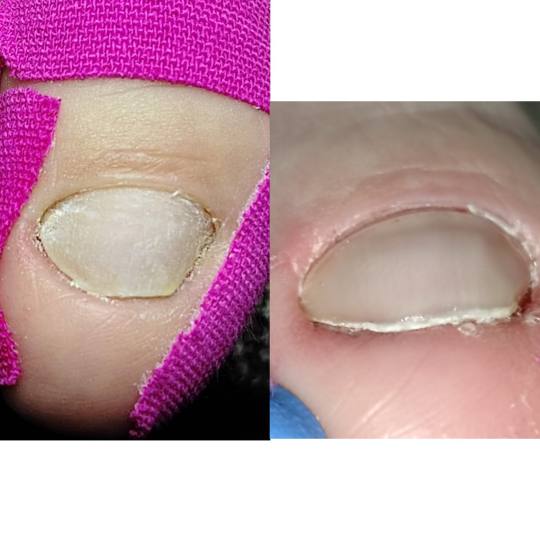 Manikir Prestige #kraljevo