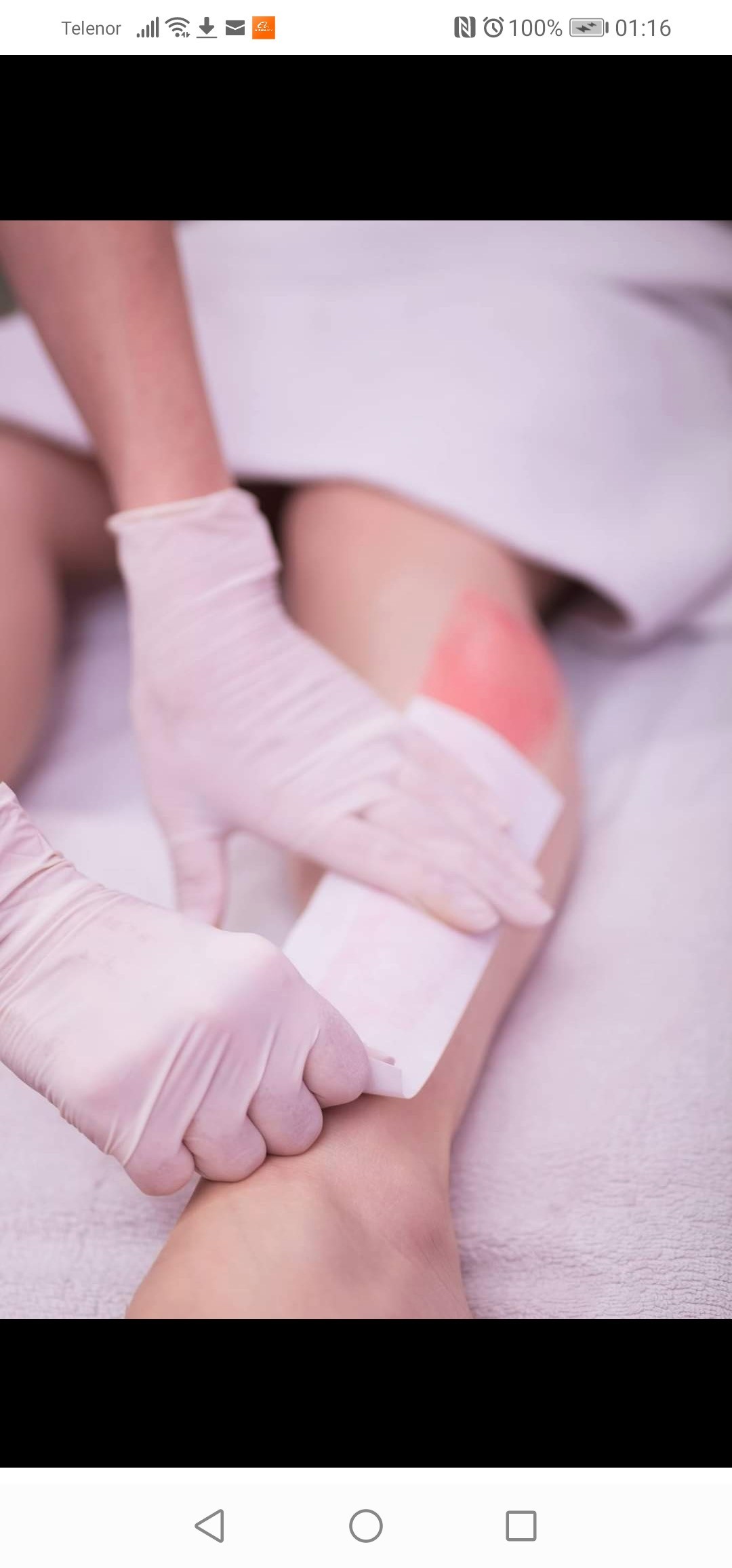 Beauty Studio Asja 2 #novisad Depilacija voskom Depilacija celih leđa hladnim voskom - za dame