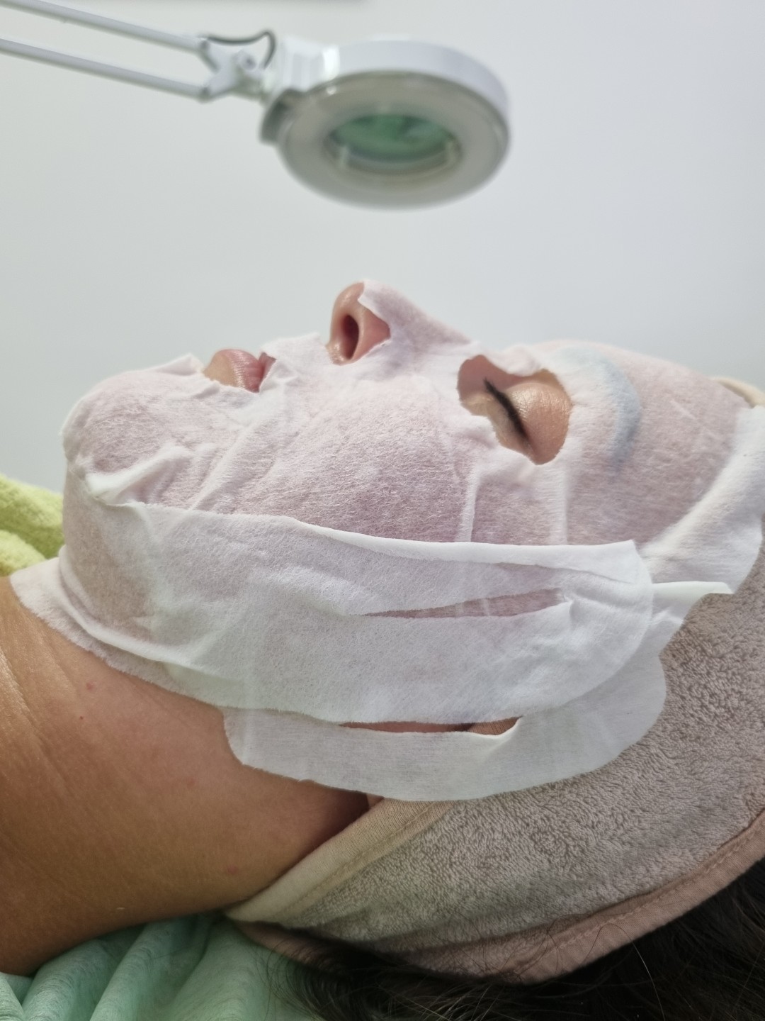Emilly #beograd Tretman lica Biorevitalizacija lica