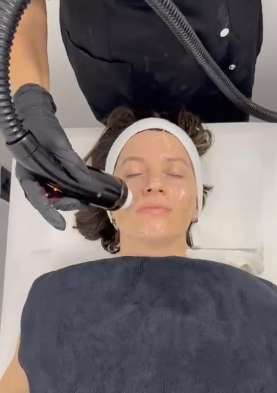 Elevent #beograd Radiotalasni i ultrazvučni tretmani Raditalasni lifting - lice