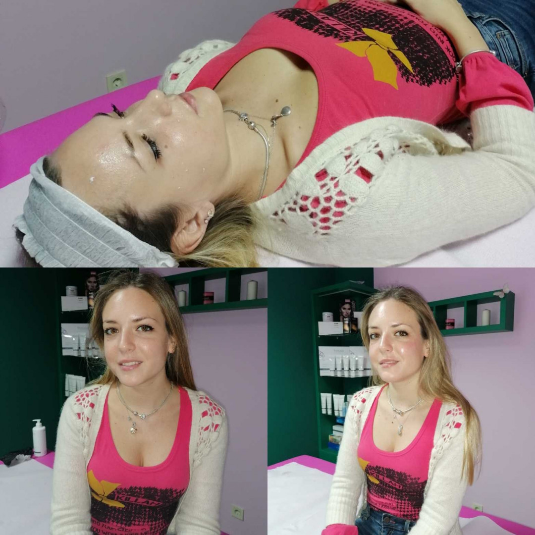 Butterfly Studio #beograd Tretman lica