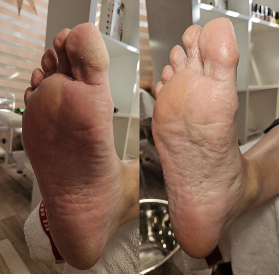 Starmedic #beograd Estetski pedikir Ruski pedikir bez lakiranja