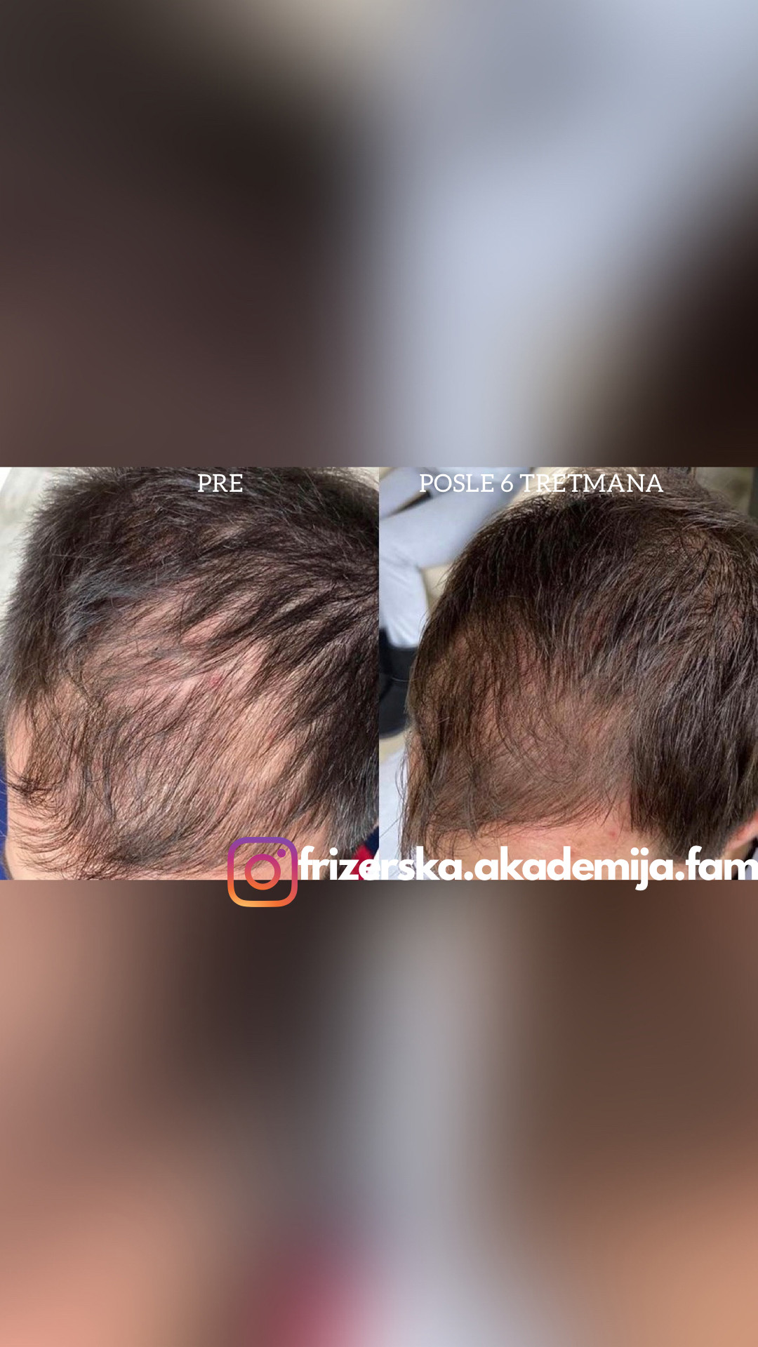 Fam Beauty Box #beograd Nega i ojačavanje kose