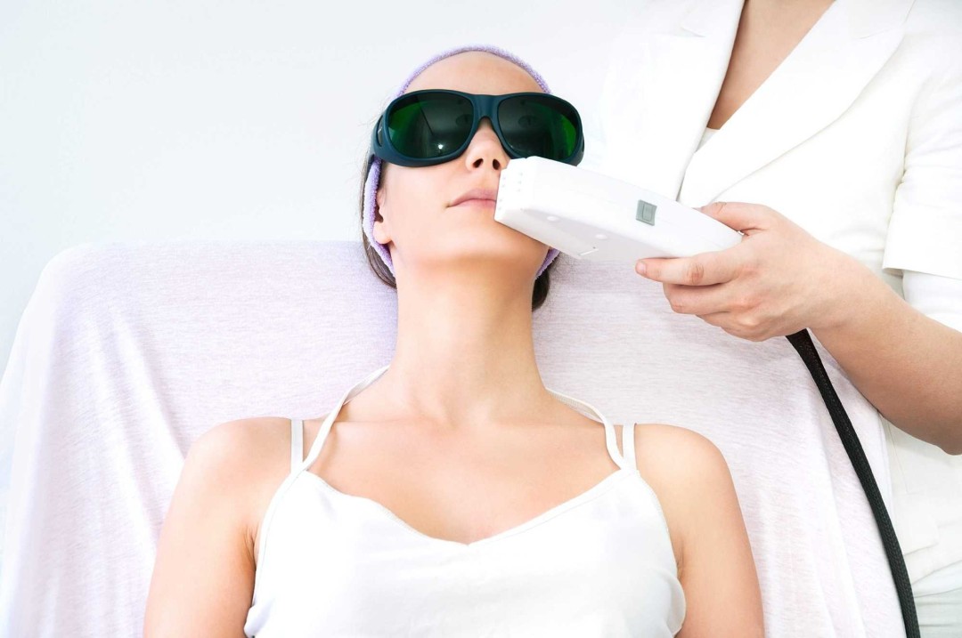 Estetik Studio Lira #beograd Epilacija IPL aparatom Epilacija celog lica