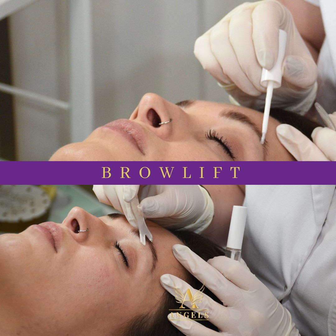 Angels #novisad Obrve Brow lift