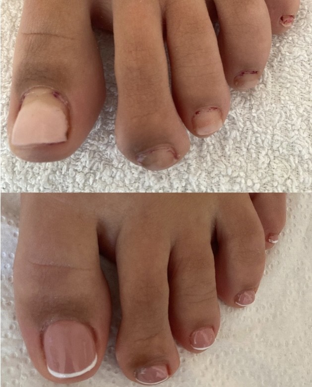 Golden Matis #beograd Estetski pedikir Estetski pedikir + korekcija gel laka (skidanje+novi)