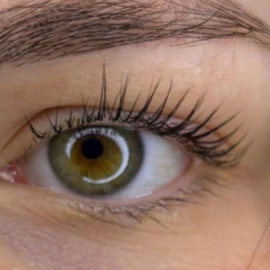 MiViDa Beauty System usluga
