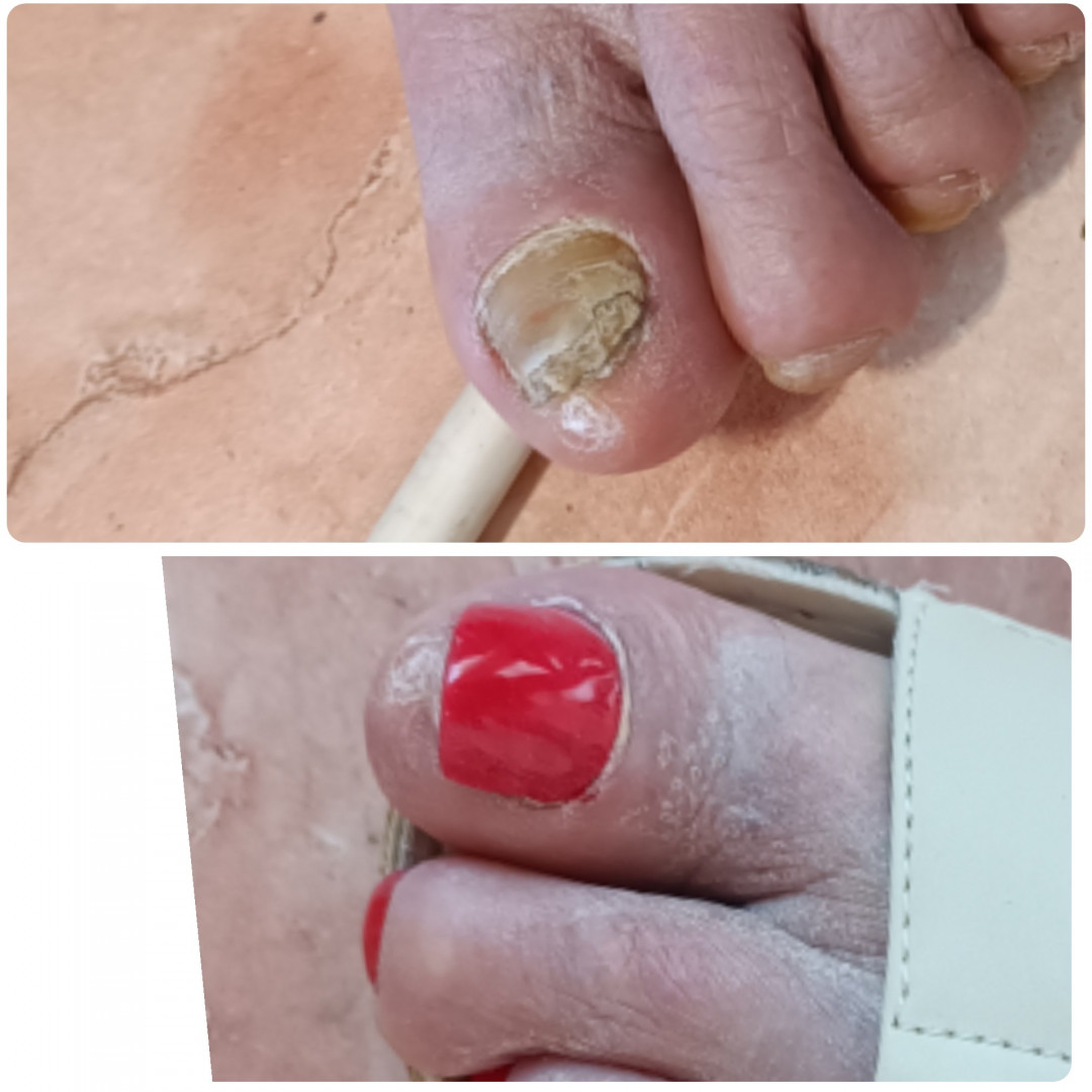 Nail Studio MPN #beograd Estetski pedikir