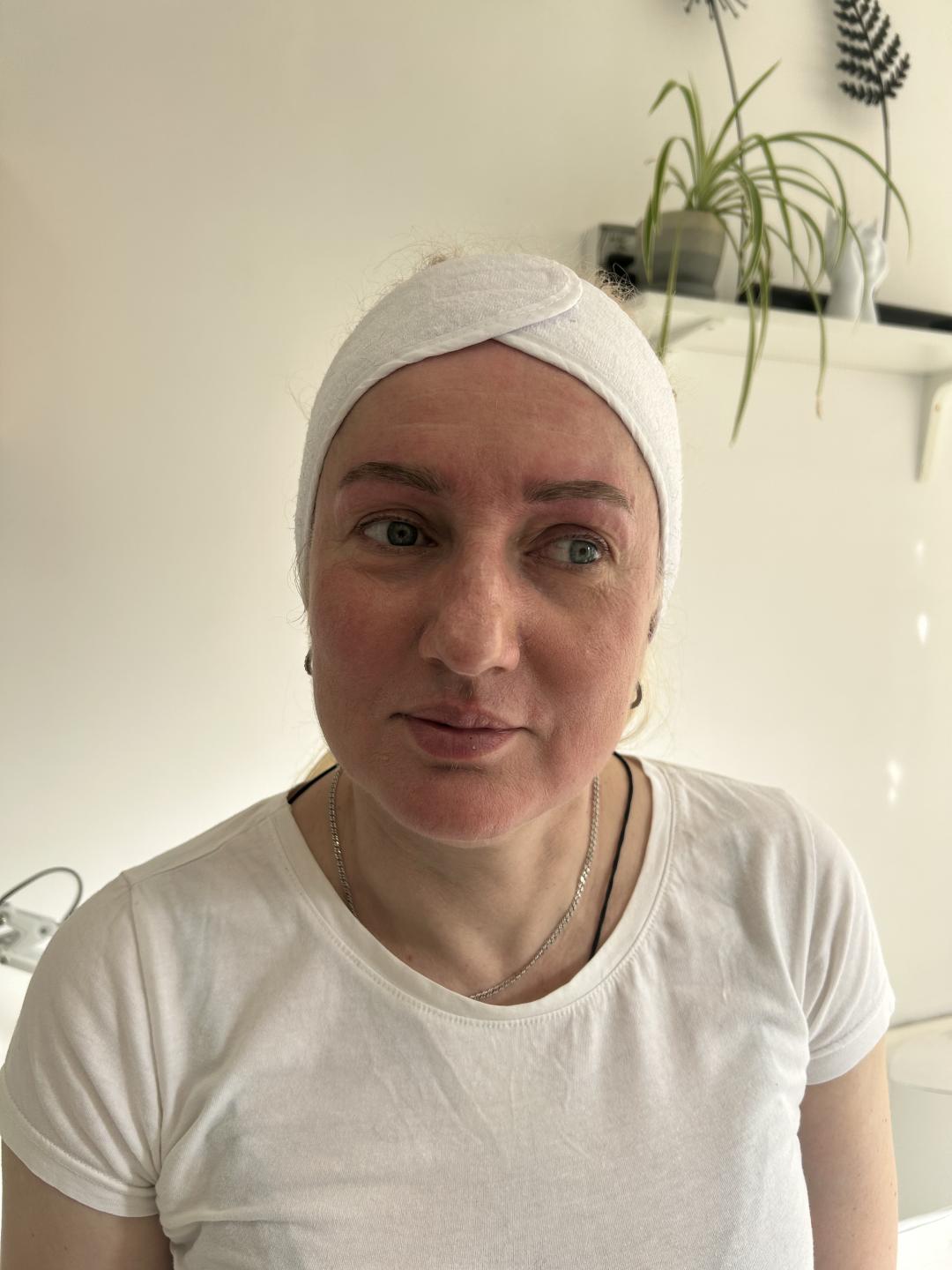 Oblikovanje obrva pincetom - Sandra estetik studio, Beograd Obrve Lice Obrve, Beograd, Banovo brdo