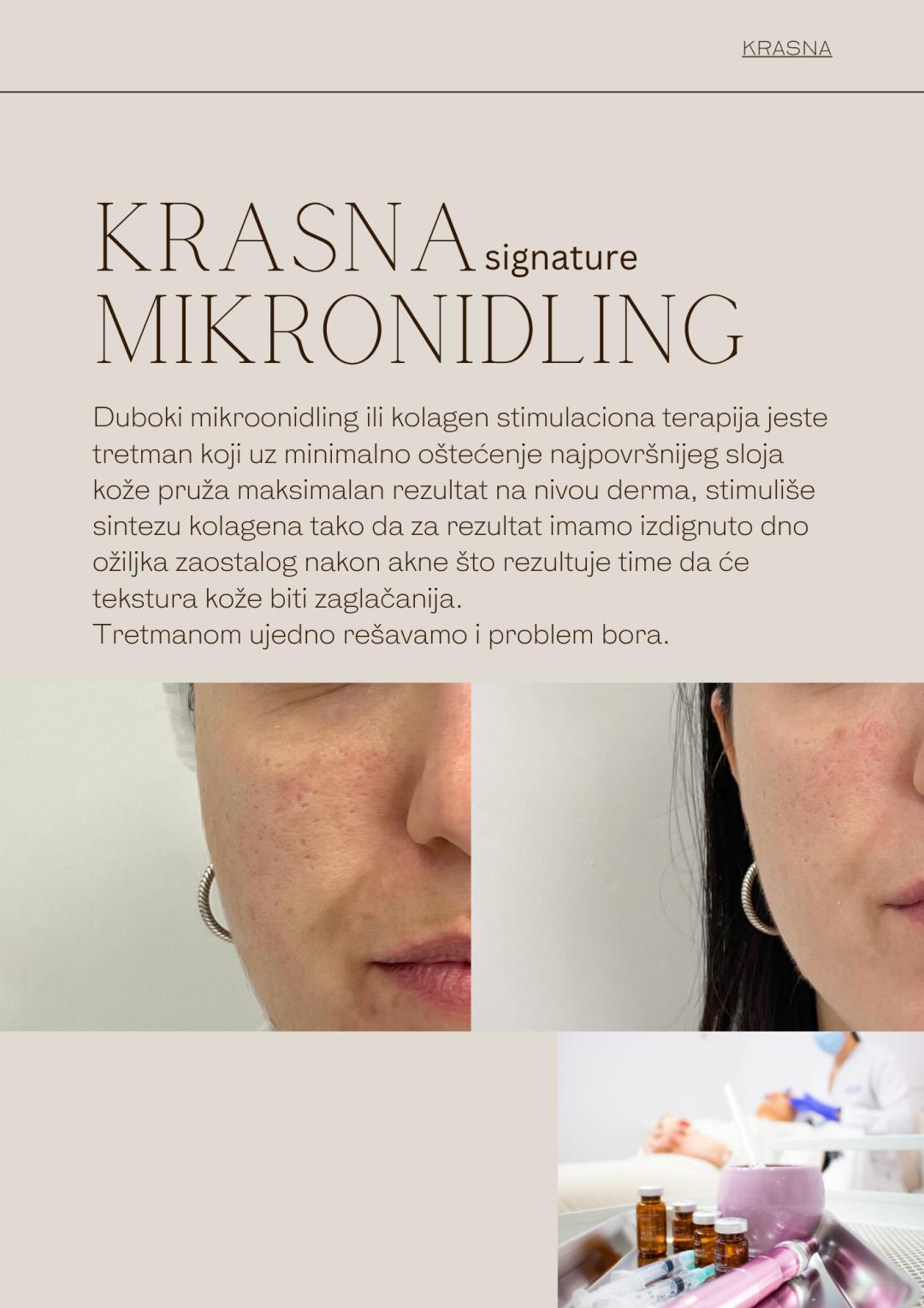 KRASNA signature MIKORNIDLING - Krasna, Beograd Tretman lica Lice Tretman lica, Beograd, Vračar, Čubura, Crveni krst