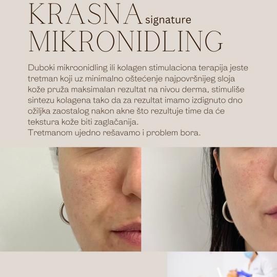 Krasna usluga
