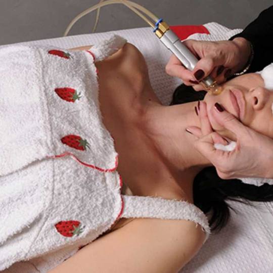 Grossi cosmetic #beograd Mikrodermoabrazija
