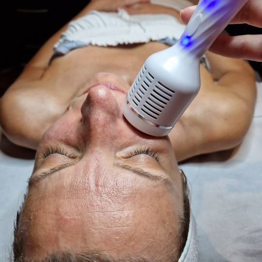 Starmedic #beograd Tretman lica Hidratacija kože - tretman lica