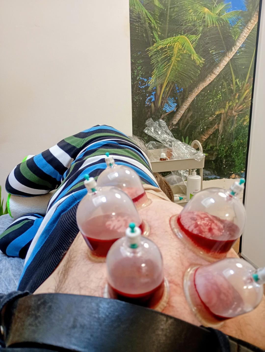 Mokra hidžama - parcijalna - Fizio Odmorko, Beograd Terapeutski tretmani Wellness Terapeutski tretmani, Beograd, Zemun Gornji grad, Zemun polje, Altina, Galenika, Batajnica