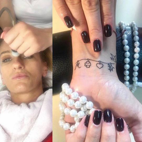 Studio lepote ASM #beograd Mezoterapija lica Mezoterapija bez igle - lice + vrat + dekolte ?Najveće