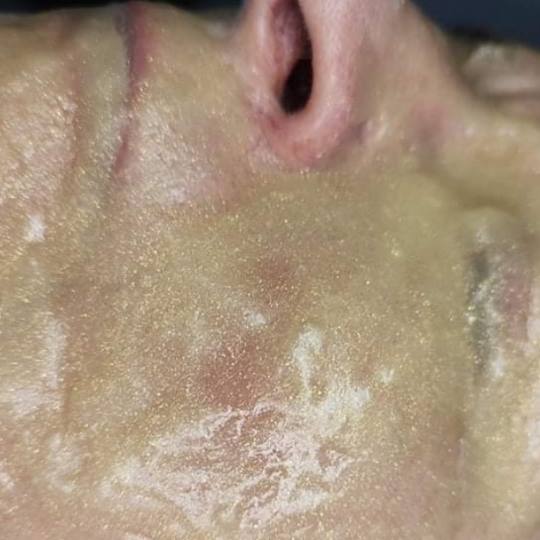 SunBox #beograd Masaža lica Soft Spa tretman lica