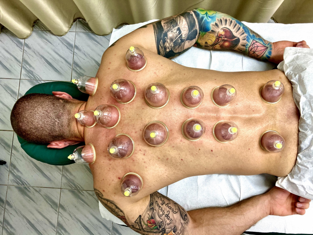 Hidžama Centar Beograd #beograd Alternativna medicina Hidžama