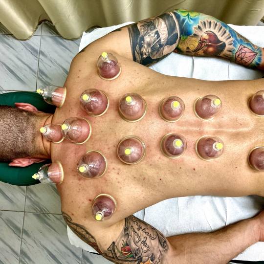 Hidžama Centar Beograd #beograd Alternativna medicina Hidžama Oporavak