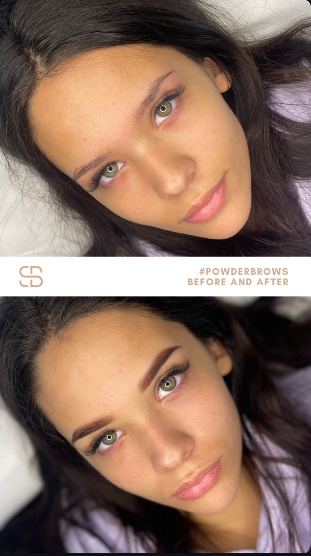 Sakura beauté #beograd Hijaluronski tretmani lica PMU obrve + prva korekcija