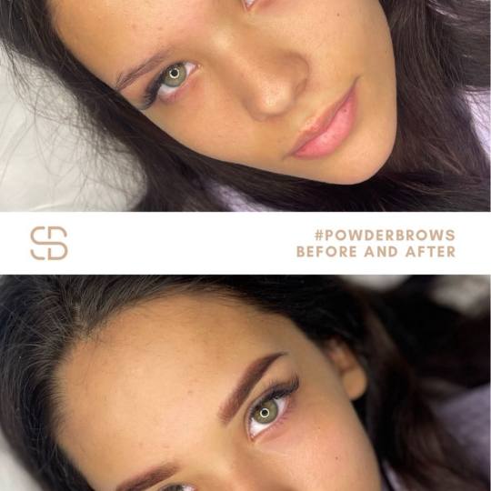 Sakura beauté #beograd Hijaluronski tretmani lica PMU obrve + prva korekcija