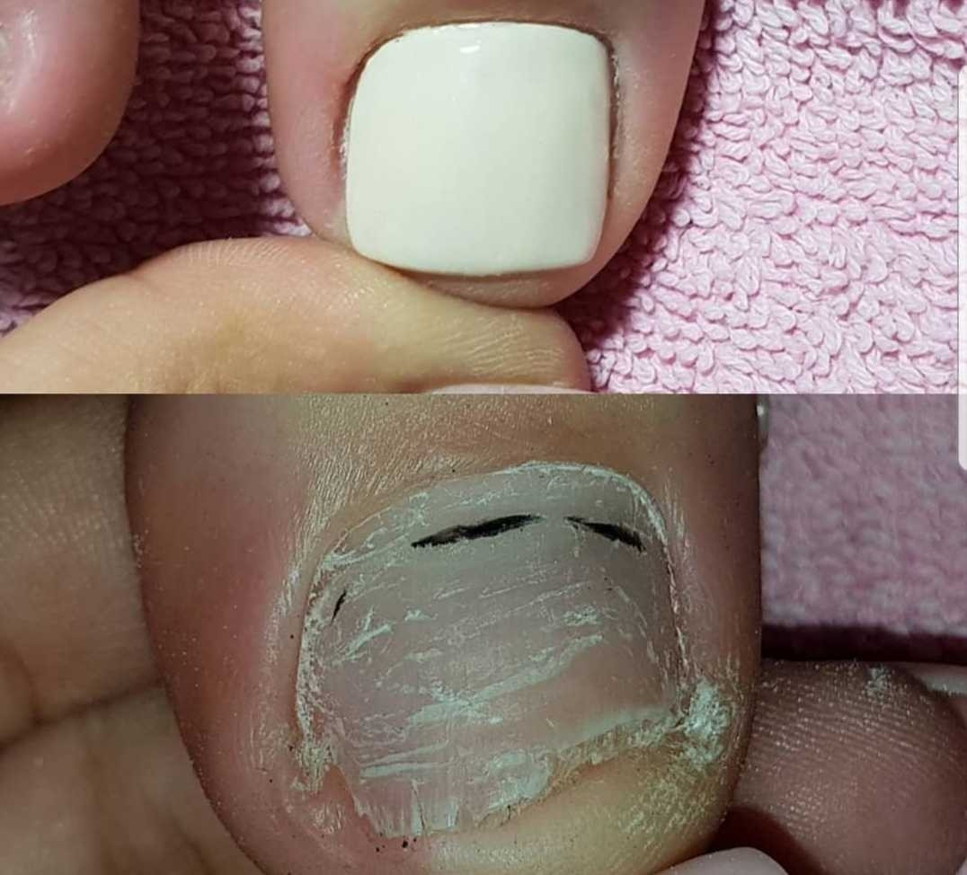 Just You Beauty & Nails #beograd Medicinski pedikir