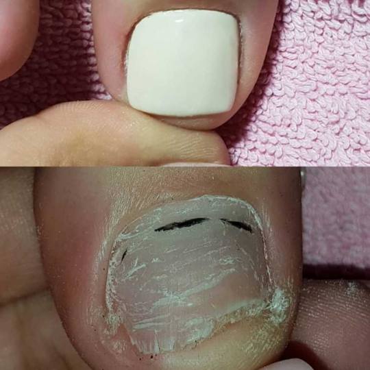 Just You Beauty & Nails #beograd Medicinski pedikir