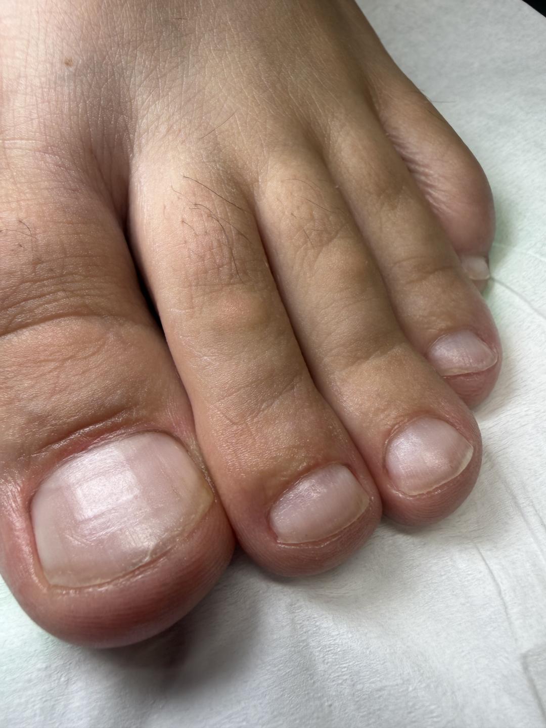 Higijenski pedikir - RS beauty studio, Novi Sad Estetski pedikir Nokti Estetski pedikir, Novi Sad, Rotkvarija, Podbara, Salajka