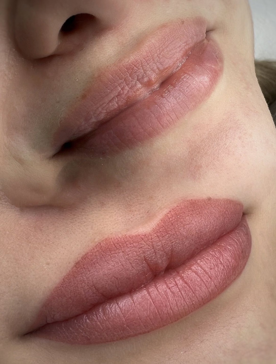 Esthetique Privé #beograd Trajna šminka Trajna šminka usana - PHILIPPS