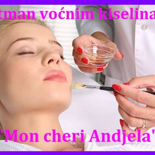 Mon cheri Anđela #beograd Tretman lica