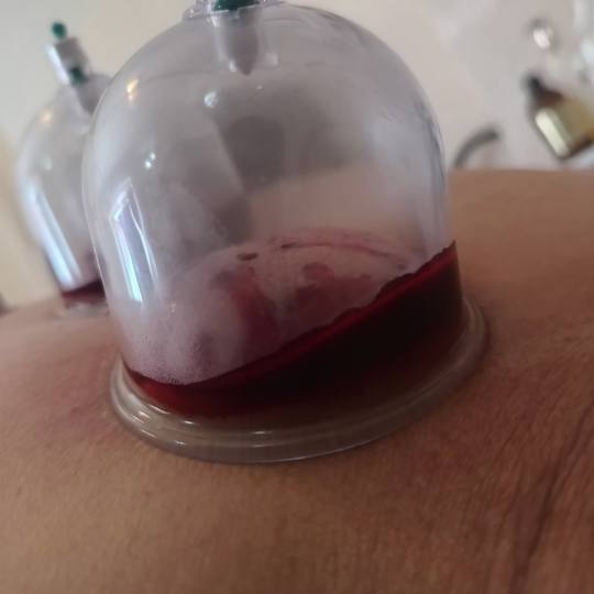 Relax body centar #zajecar Masaža teglama Mokra hidžama