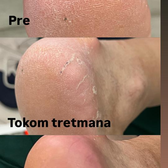 Belle Ana #beograd Estetski pedikir Ruski pedikir Ruski pedikir ✨
Ovaj precizan tretman 
Temeljn