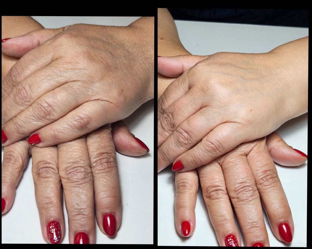Beauty salon XL Lady #beograd Parafinska pakovanja Parafinsko pakovanje - ruke