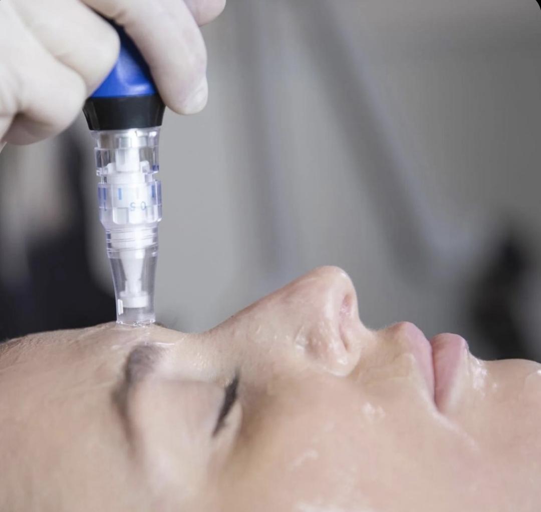 Amelini beauty concept #beograd Dermaroler i dermapen Skinpen-dermapen