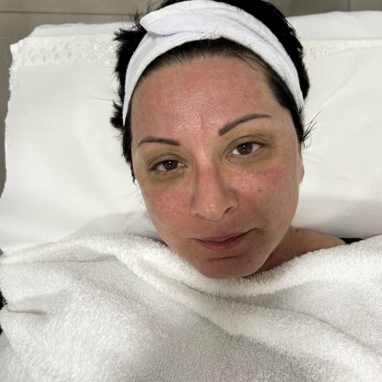 Sandra estetik studio usluga