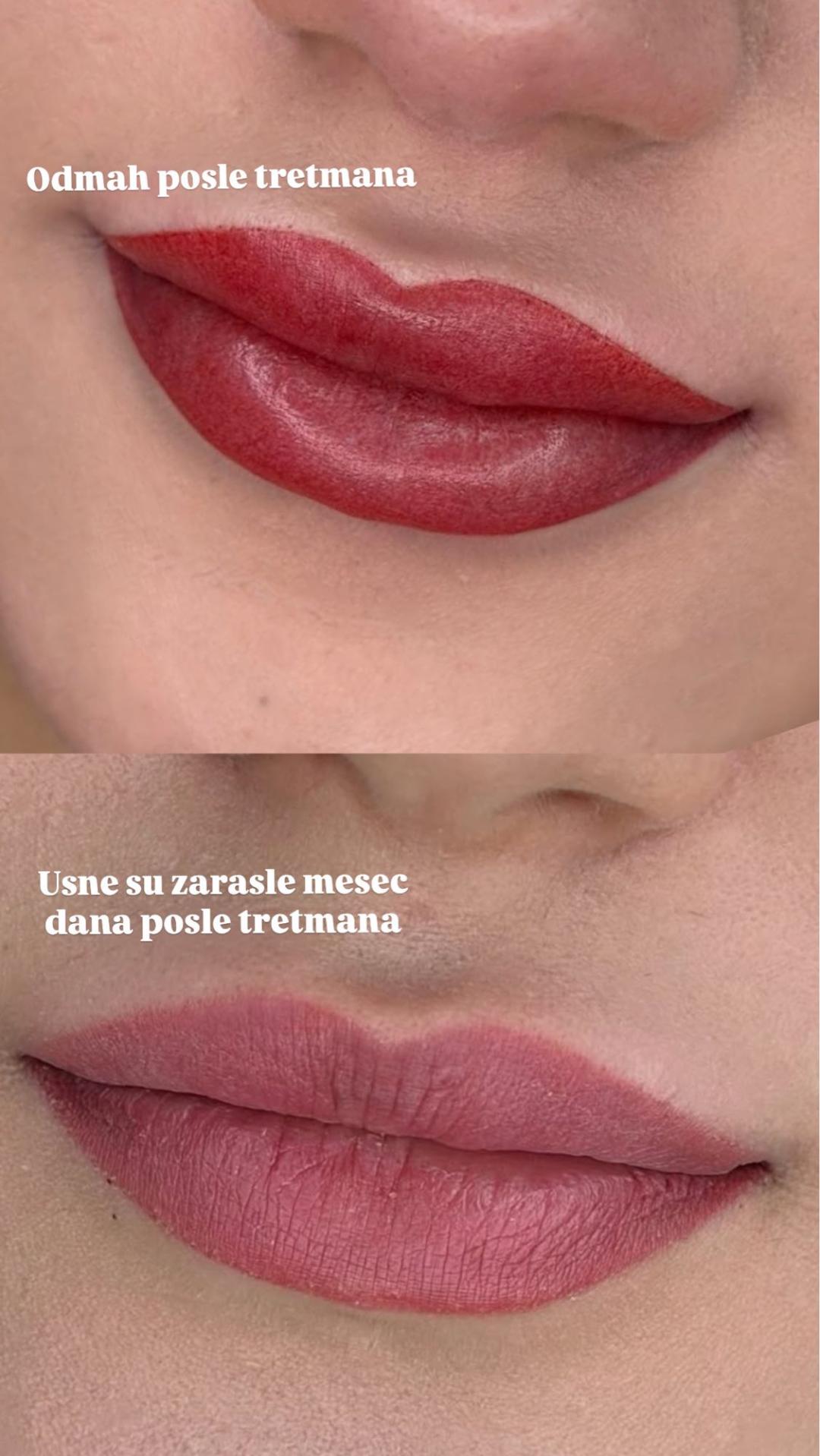 Trajna šminka - usne - AmiSo Beauty Studio, Novi Sad Trajna šminka Lice Trajna šminka, Novi Sad, Centar - Stari grad
