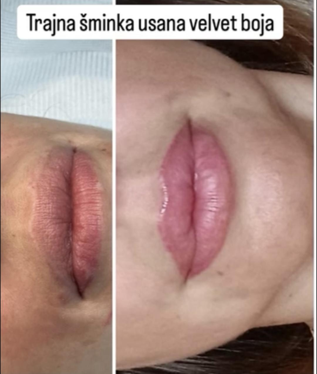 Trajna šminka - usne - Petra beauty concept, Beograd Trajna šminka Lice Trajna šminka, Beograd, Vračar, Čubura, Crveni krst