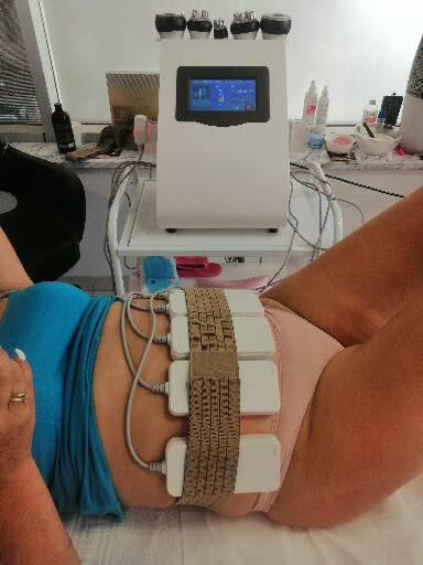 Lipolaser Centar - Matrix021 #novisad Tretmani tela