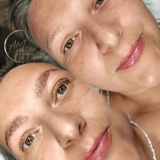 AM BEAUTY STUDIO #odzaci Tretman lica SUMMER TOTAL LOOK