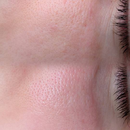 Brow & Glow #novisad Tretman lica Higijenski tretman lica Slika gore pre i slika dole nakon higijens